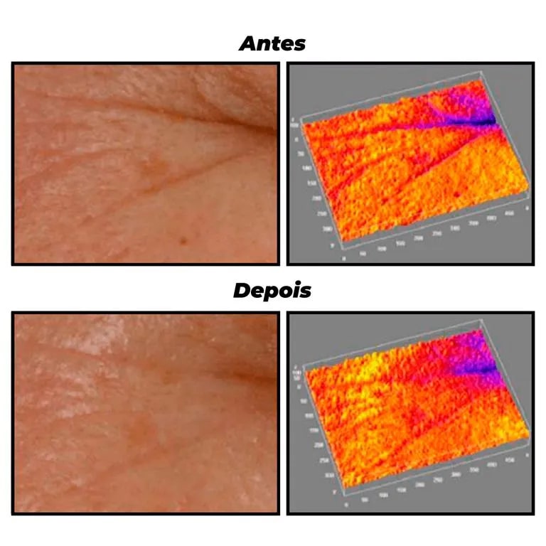 Creme-De-Tratamento-30g-Anti-Idade-Intensivo-Retinol---Creamy-810058